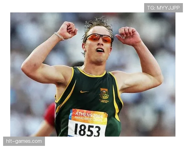 奥斯卡·皮斯托瑞斯家里装了三套假肢，一套跑步用，一套洗澡用，还有一套……专门配西装